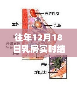 女性乳房实时结节分类解析，关注乳房健康的关键一环（往年12月18日乳房实时结节三类解析）