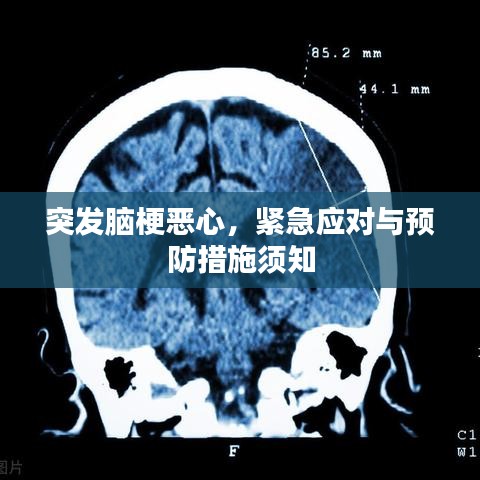 突发脑梗恶心，紧急应对与预防措施须知