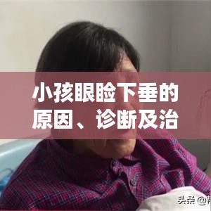 小孩眼睑下垂的原因、诊断及治疗方法详解